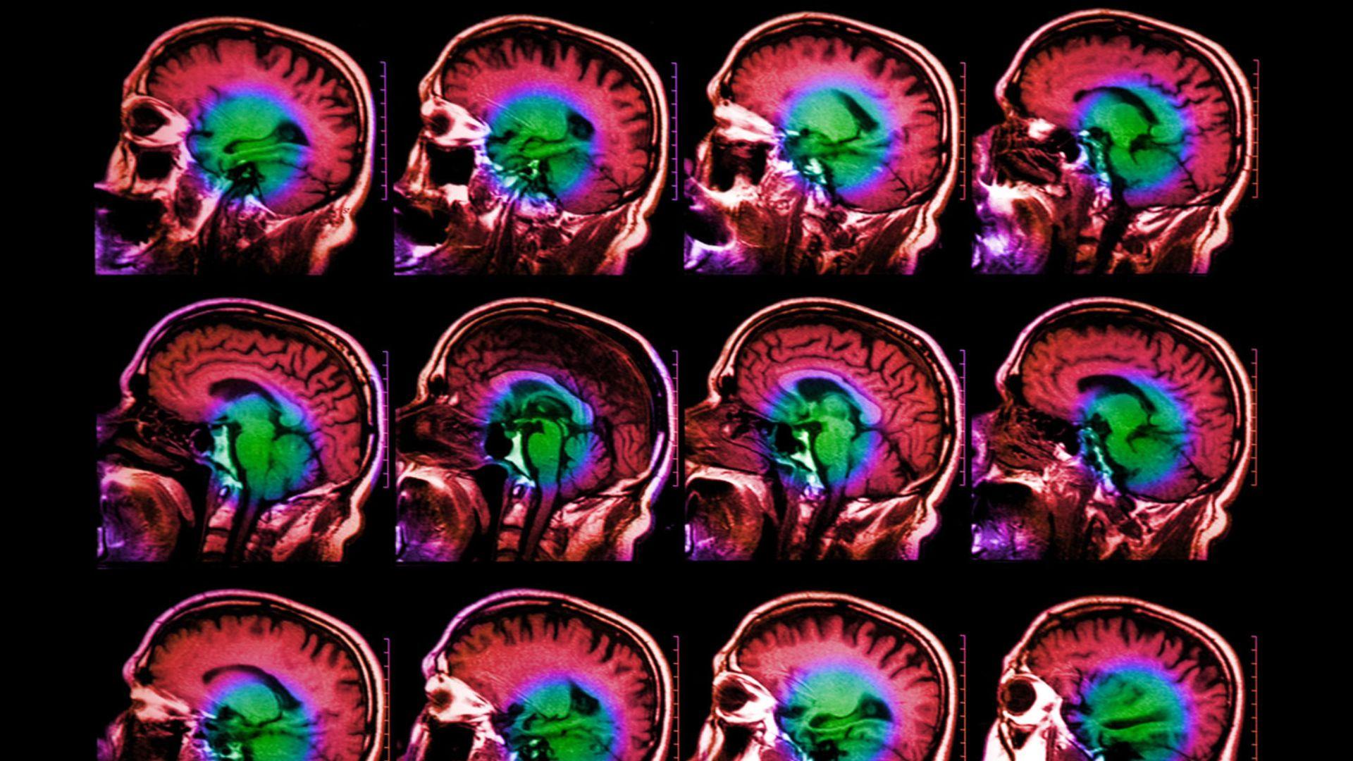 MIT neuroscientists discover neurons with 全网最准澳洲幸运10计划软件, 官网手机版app下载 distinct language processing timescales