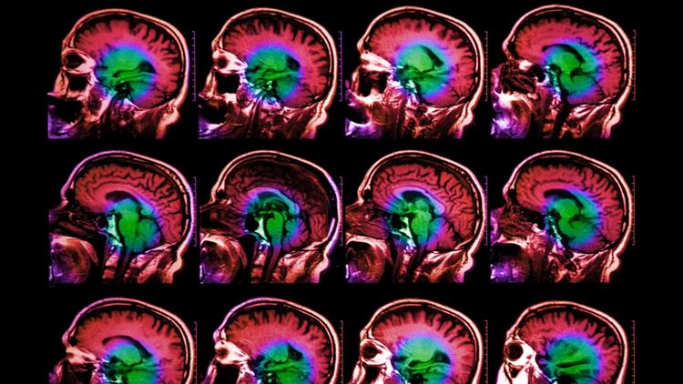 MIT neuroscientists discover neurons with distinct language processing timescales